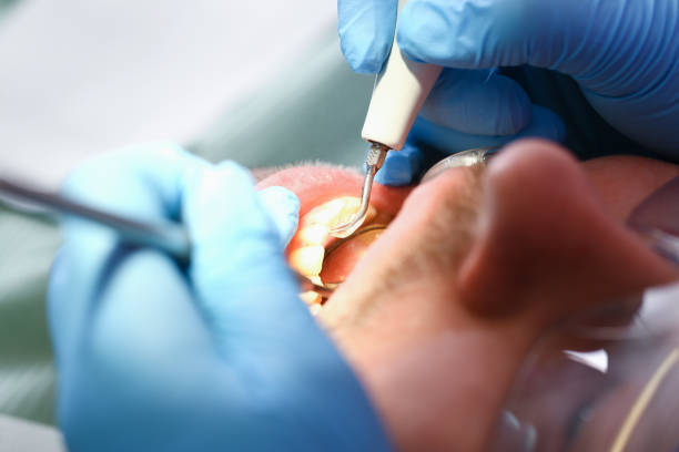 Best Broken Tooth Emergency  in Franklinton, LA