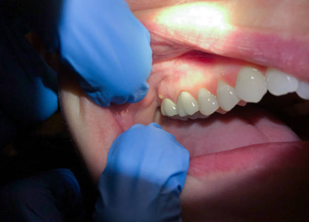 Best Broken Tooth Emergency  in Franklinton, LA